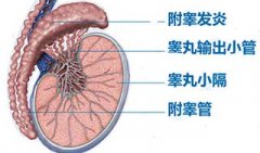 附睾炎的常见原因有哪些