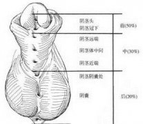 尿道下裂的症状和分型