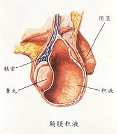 南京治疗精索炎哪家医院专业