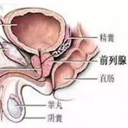 前列腺钙化的症状是什么